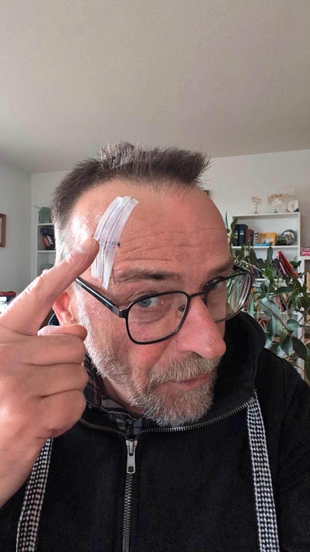 Wenn man nachts im Schlaf durch die Wohnung läuft und dann hinfällt. Habe mir eine Platzwunde zugezogen und musste mitten in der Nacht ins Krankenhaus. Nochmals gut gegangen. Hätte schlimmer ausgehen können.